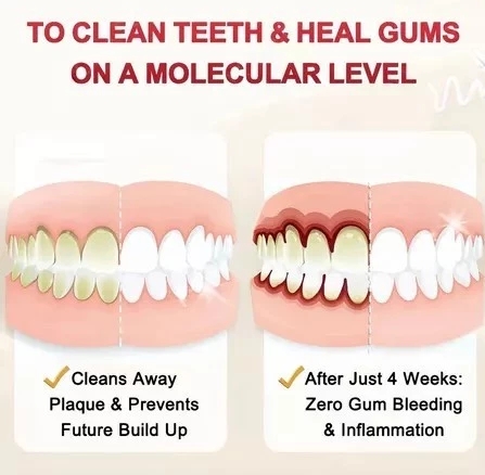 FreeShipping Philippines (10pcs Toothpaste Free 6pcs toothbrush) Probiotic Caries Toothpaste SIP-4 Whitening Tooth Decay Repair Paste Teeth Cleaner Plaque Remover FreeShipping Philippines (10pcs Toothpaste Free 6pcs toothbrush) Probiotic Caries Toothpaste SIP-4 Whitening Tooth Decay Repair Paste Teeth Cleaner Plaque Remover